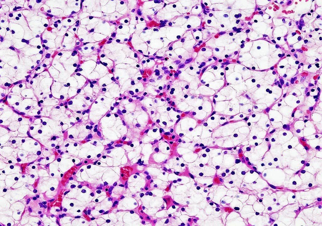 A Comprehensive Guide to Understanding Hematoxylin and Eosin Staining